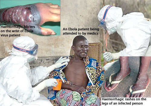 Treating patients with Ebola requires much preventive care. Photo from tribune.com.ng 