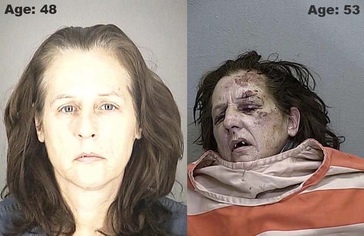 The shocking effects of meth use. Photo from cbsnews.com 