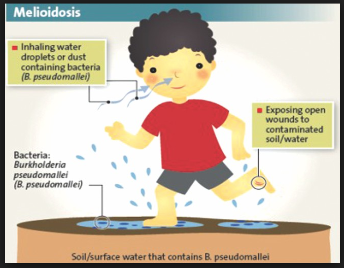 how melioidosis spread enter body. Image from lifeseasiamagazine.com
