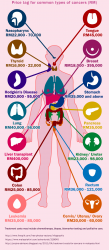 How much does it cost to treat cancer in Malaysia? Here's a ...