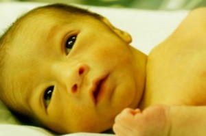 Jaundice-In-Newborn-Babies