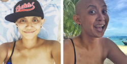 How this Malaysian woman didn’t let having 1 breast stop her from wearing a bikini