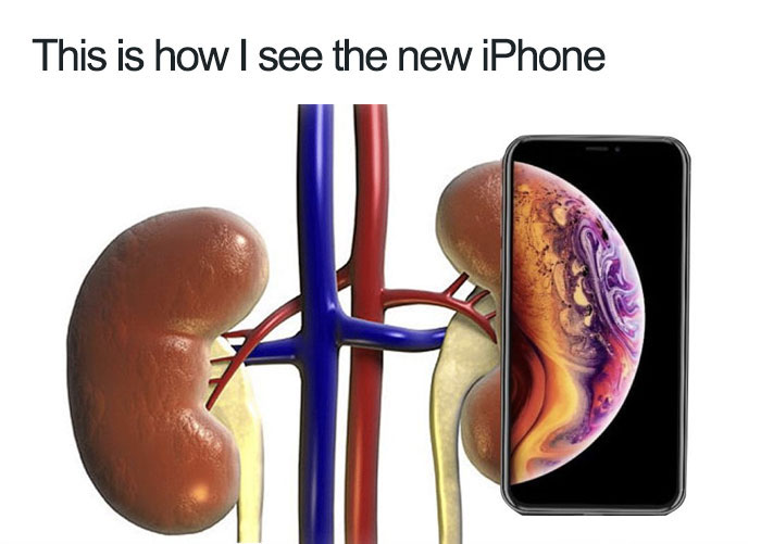 iphone kidney