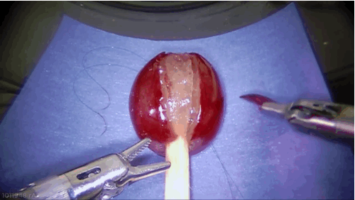 We don't think they did surgery on a mandarin tho. GIF from Buzzfeed