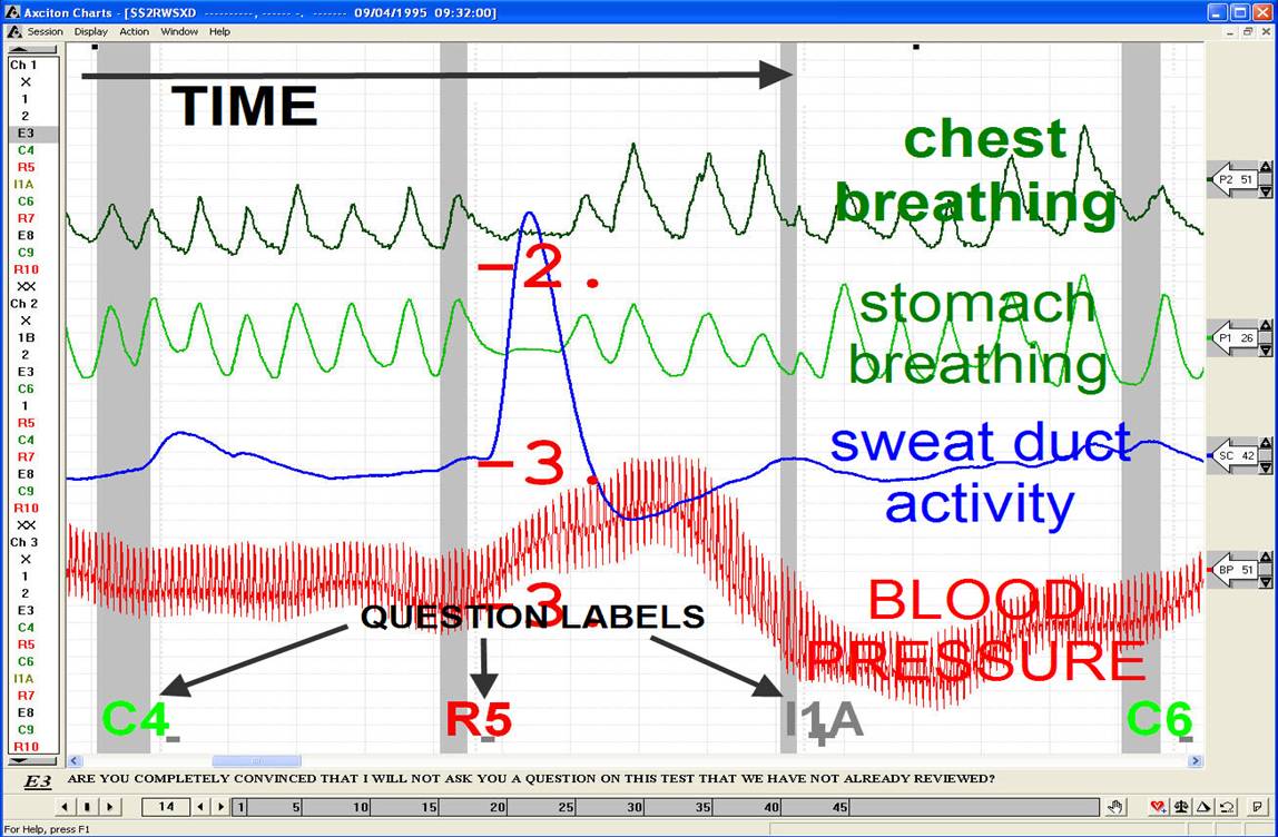 A sample polygraph graph. Img from InsuranceGateway.