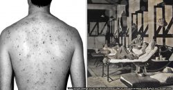Chickenpox made social distancing necessary in 1800s Malaya. Here’s how they did it.