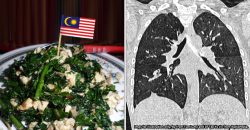 This Malaysian sayur may help you lose weight. It may also give you a deadly lung disease.