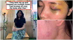 Domestic Abuse Case Of A M’sian Chinese Girl Due To Racism